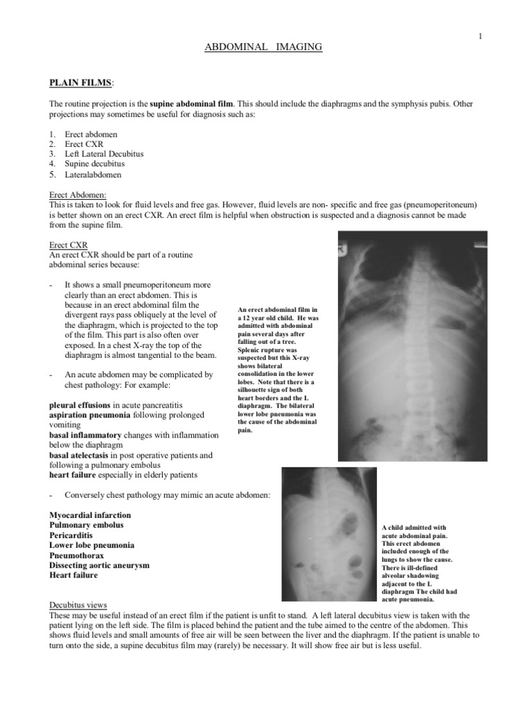 Abdomen | PDF | Esophagus | Crohn's Disease