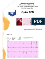 Quizz ECG