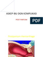 ASKEP  KOMPLIKASI perdarahan post partum