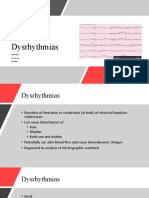 Perfusion. Dysrhythmias - Pacemaker.aicd