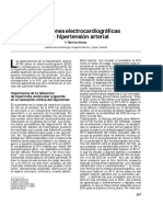 Alteraciones Electrocardiográficas en La Hipertensión Arterial