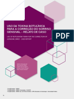 Uso Da Toxina Botulínica para A Correção Do Sorriso Gengival - Relato de Caso