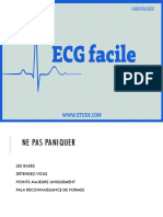 Ecg Facile