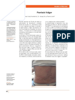 Psoriasis Vulgar: Imágenes en Medicina