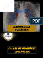 Aula 6 Pneumotorax Pneumomediastino E Enfisema Subcutaneo