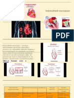 Інфекційний ендокардит