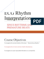 ECG Rhythm Interpretation: Sinus Rhythms and Premature Beats