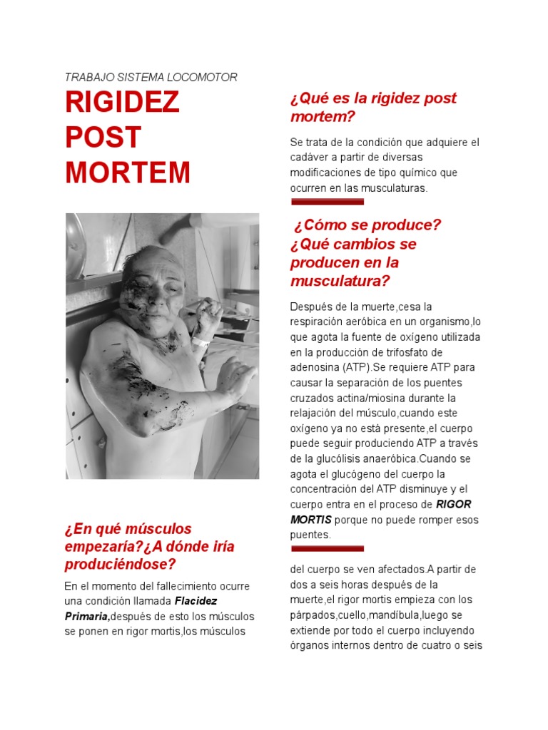 Rigor Mortis | PDF