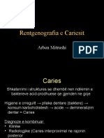 Rentgenografia e Cariesit: Arben Mitrushi