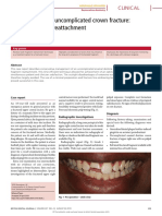 A Case Report of Uncomplicated Crown Fracture - Tooth Fragment Reattachment