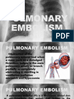 Pulmonary Embolism