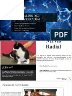 Paralisis Del Nervio Radial