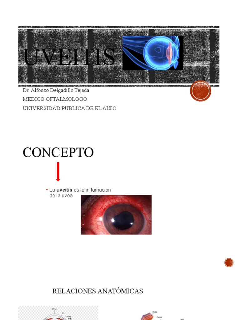 UVEITIS | PDF | Ojo humano | Percepción visual