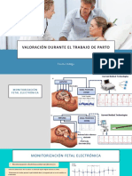 Monitoreo Fetal  PDF