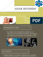 Paladar Hendido