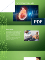 Electrocardiograma Ekg