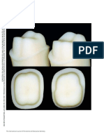 Preparaciontooth Structure Removal Associated With Various PR