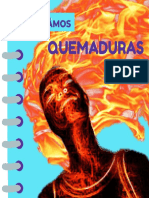 Quemaduras