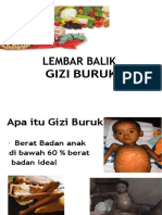 Lembar Balik Gizi Buruk 2