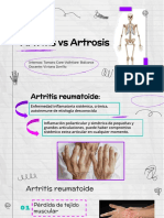 Artritis vs Artrosis