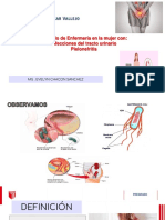 Sesión 4 Pielonefritis