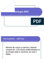 Hidrocefalia