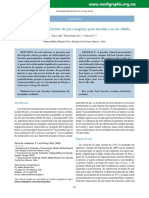 Un Caso Atípico de Fractura de Pie Compleja Postraumática en Un Adulto