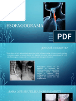 ESOFAGOGRAMA