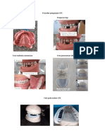 Prosedur Pengerjaan GTC Foto Pencetakan Preparasi Gigi