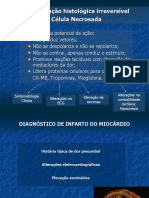 AULA_Infarto_Agudo_do_Mioc_Ardio