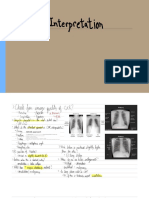 Geeky Medics CXR Interpretation