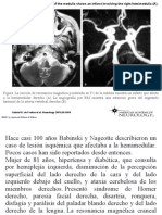 Gabriel R. de Freitas Et Al. Neurology 2001 56:1604: ©2001 by Lippincott Williams & Wilkins