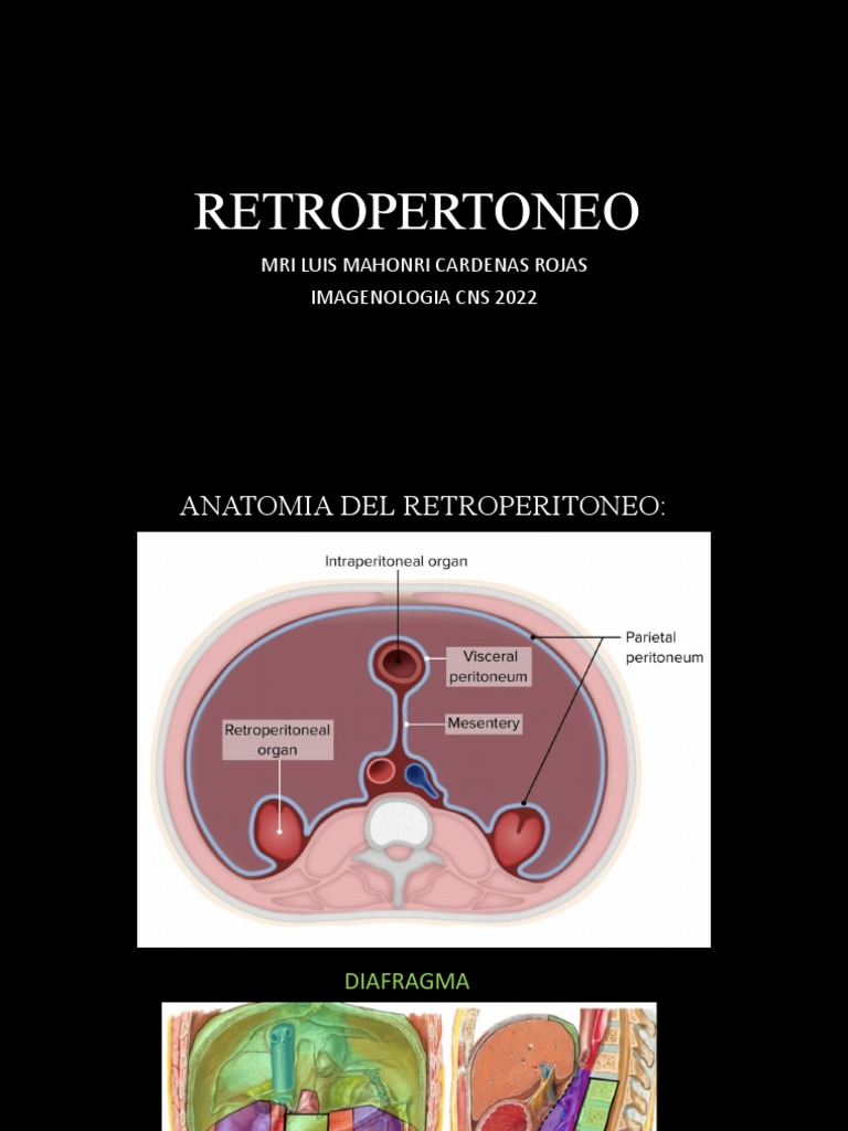 Retroperitoneo | PDF