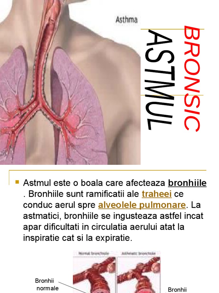 Astmul Bronsic | PDF