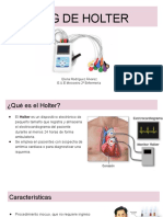 Holter ECG: Guía completa sobre el monitoreo cardíaco ambulatorio