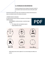 TEMA 4. NEUROIMATGE