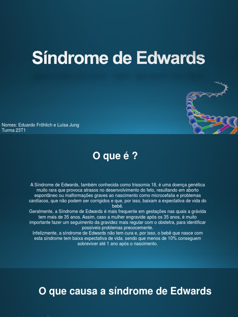 Síndrome de Edwards: Guía Esencial | PDF