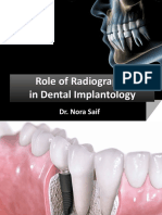 Handout. FUE. Role of Radiography in Dental Implantology
