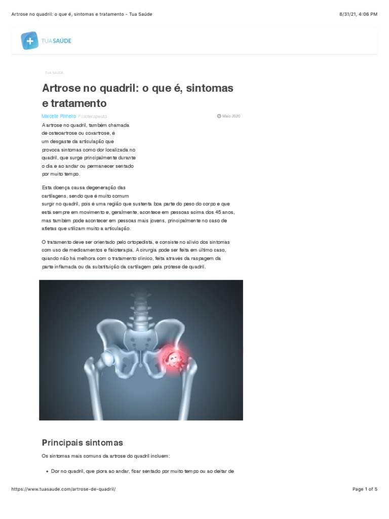 Actualizações sobre o exercício para a OA do joelho | Artigo do blogue, image size:768x1024