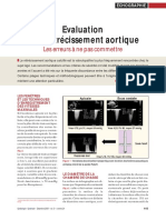 Echographie - Evaluation D'Un Rétrécissement Aortique