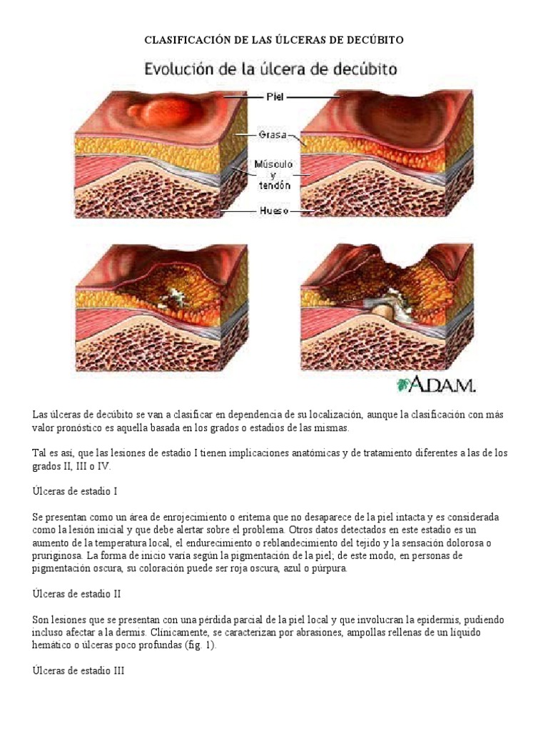 Ulceras Decubito | PDF | Ciencia y matemáticas