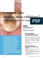 Comment Faire Uninlay-Onlay Esthetique