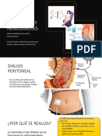 Diálisis peritoneal vs hemodiálisis