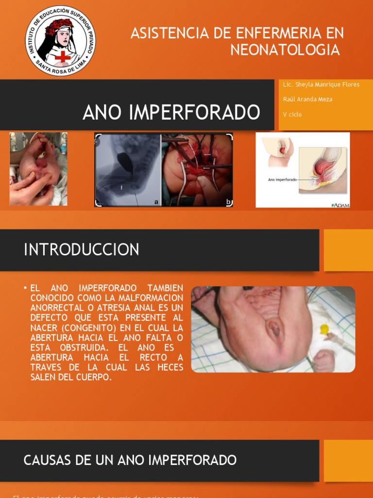 Manejo del Ano Imperforado en Neonatos | PDF | Medicina | Enfermedades ...