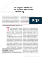 Management of Purpura Fulminans Skin Lesions in A Premature Neonate With Sepsis: A Case Study