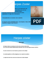 Herpes Zoster