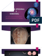 Hematoma Epidural y Subdural