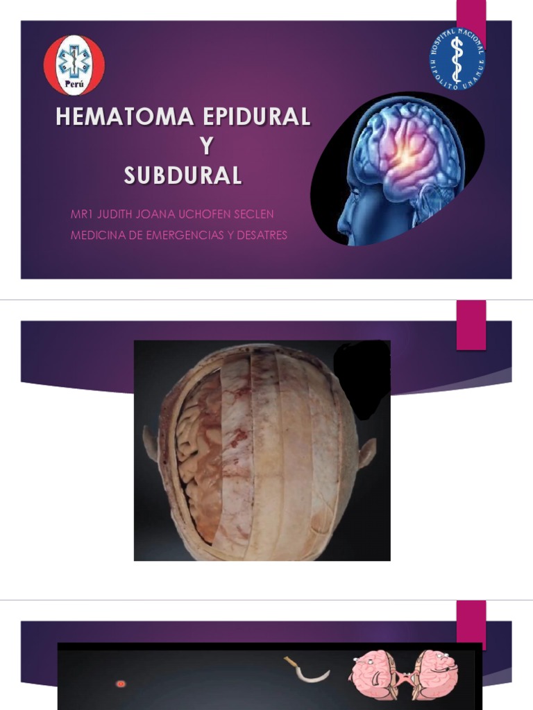 Hematoma Epidural y Subdural | PDF | Plaqueta | Lesión