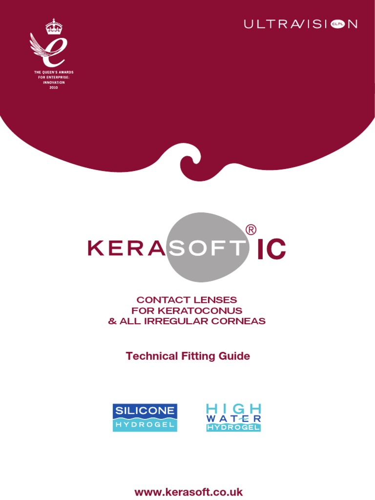 Kerasoft Lens (Optics) Cornea
