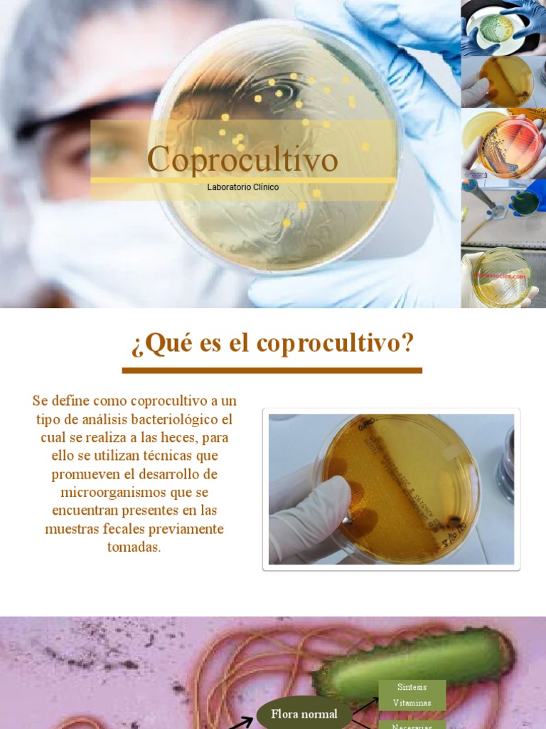 identificaci-n-y-aislamiento-de-bacterias-intestinales-a-trav-s-del